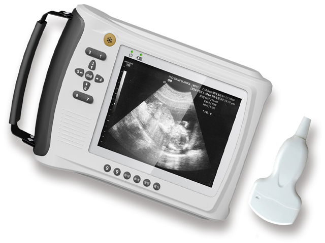掌上型B超 数字B超 预产期 胎心 品质保证 厂家直销