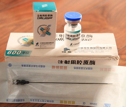 注射用膠原酶#膠原酶價格#膠原酶效果