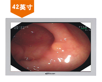 安立信42寸醫(yī)用顯示器LC-MS4201EO