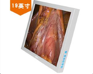 19寸內(nèi)窺手術(shù)醫(yī)用顯示器