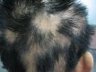石家莊腦系醫院專業zl脫發、白發的醫院原始圖片2