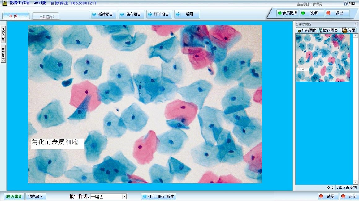 液基细胞学检测报告系统
