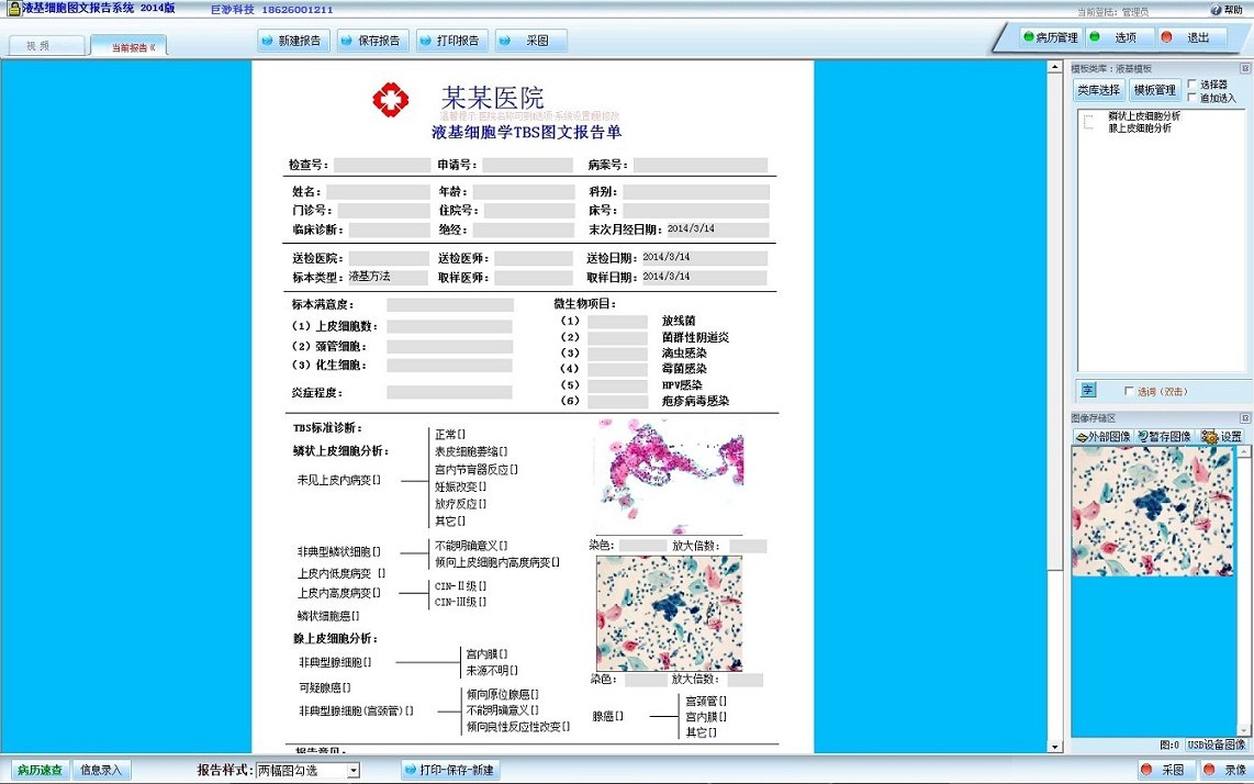 液基细胞学检测报告系统