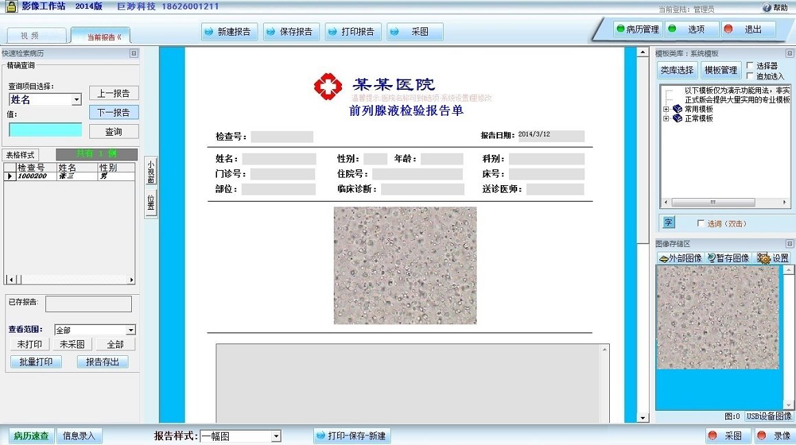 前列腺液检查报告系统