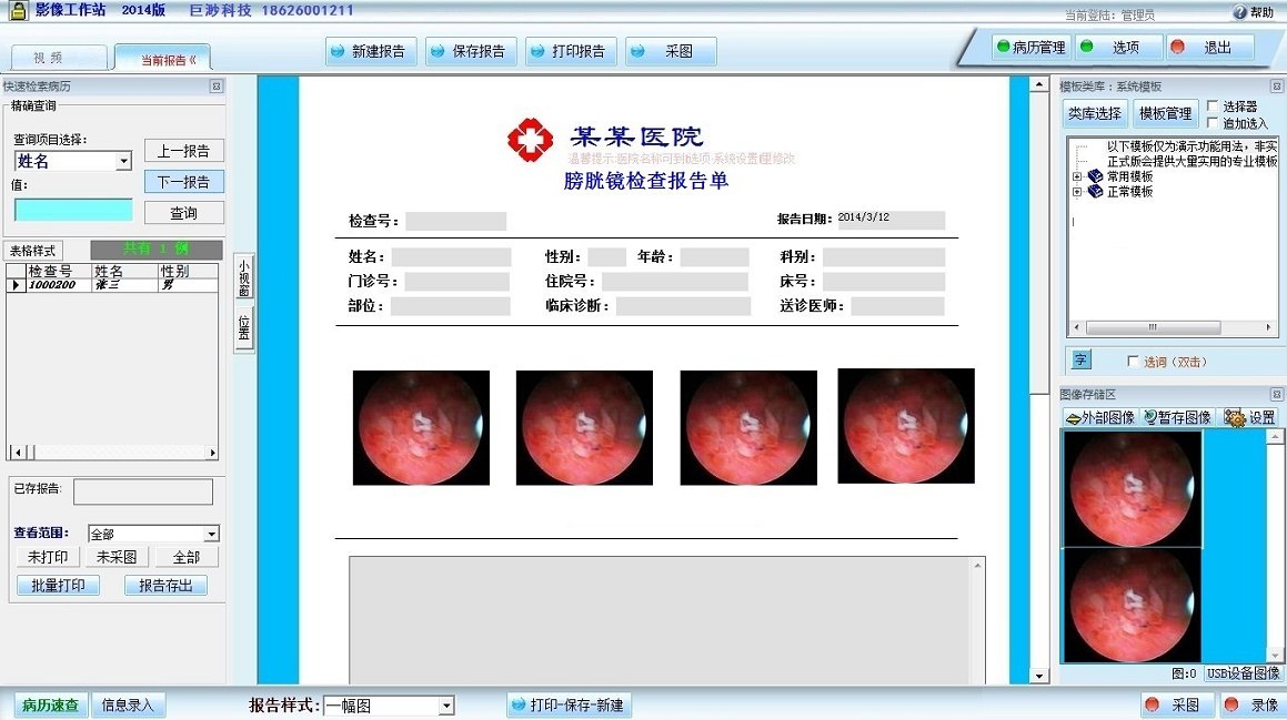 膽道鏡影像工作站