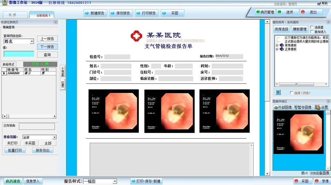 支气管镜影像工作站