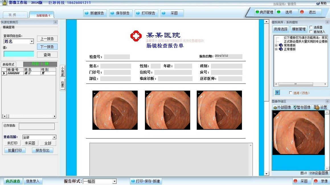 腸鏡影像工作站原始圖片2