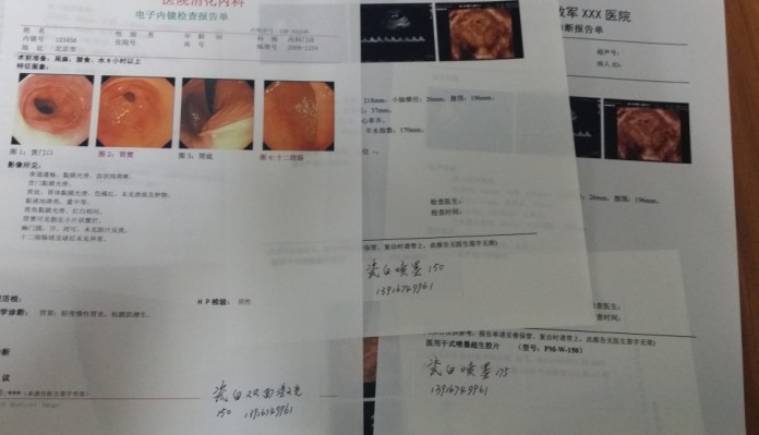 激光膠片原始圖片2