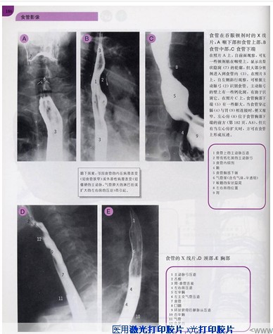 放射科噴墨激光打印膠片