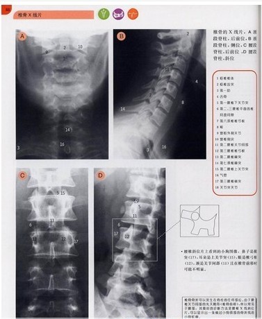 噴墨DR膠片