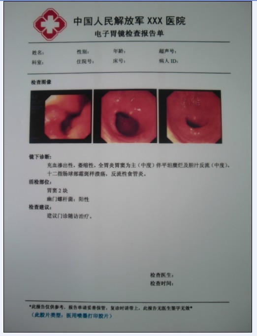 激光醫用膠片 