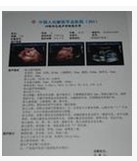 激光醫(yī)用膠片 原始圖片2