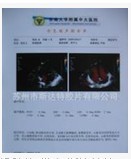 激光醫(yī)用膠片 原始圖片3