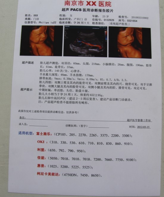 醫用B超噴墨膠片