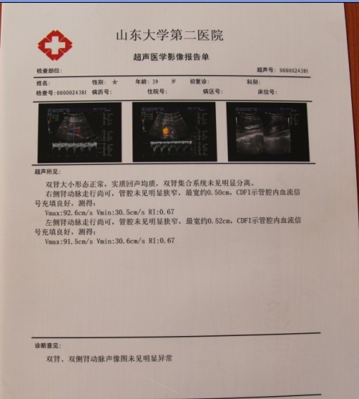 醫(yī)用B超噴墨膠片原始圖片2