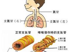 北京过敏性xczl/过敏性xc专科医院 风湿骨病